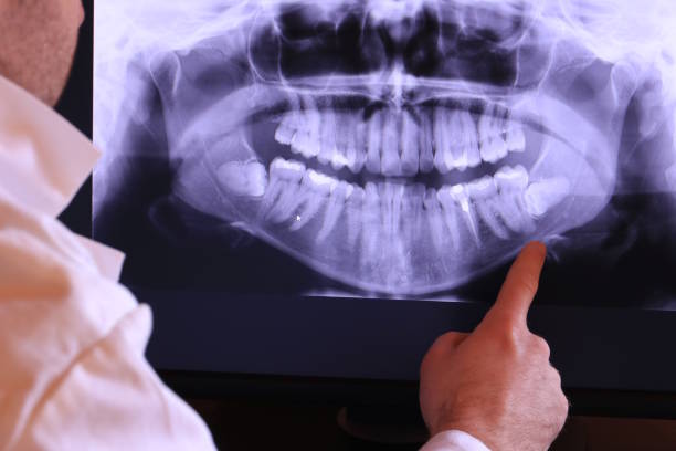 Best Pediatric Emergency Dentist in Shorewood, WI