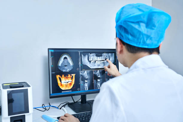 Best Emergency Root Canal Treatment in Shorewood, WI